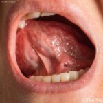 lengua-boca