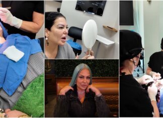 La Diosa se somete a un implante de cejas: “Estoy inflamada, pero valió la pena”